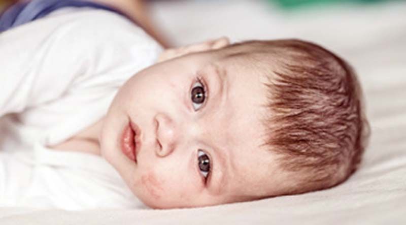 หัวใจเจ้าตัวเล็กต้องระวัง COVID-19 กับคาวาซากิ