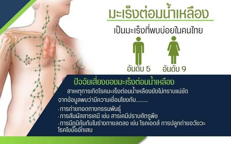 แพทย์ชี้ 'มะเร็งต่อมน้ำเหลือง' พบบ่อยในคนไทย แนะหมั่นสังเกตตนเอง