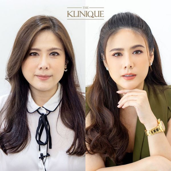 ‘ติ๊ก-กัญญารัตน์’สวยกระชากวัย