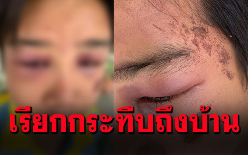 เด็ก14โดนกระทืบ หน้าปูด-ตาบวม จ่าย4หมื่นค่าทำขวัญ!!