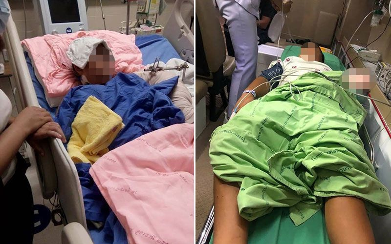 สุดสงสาร! 'น้องแมนยู'วัย9ขวบ ตาบอดไม่พอ ซ้อนจยย.เกิดอุบัติเหตุแขนซ้ายขาดอีก