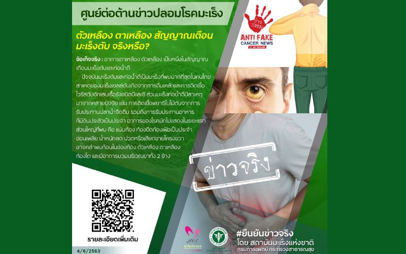 สัญญาณเตือน! ‘ตาเหลือง-ตัวเหลือง’เสี่ยงเป็นโรคมะเร็งตับ