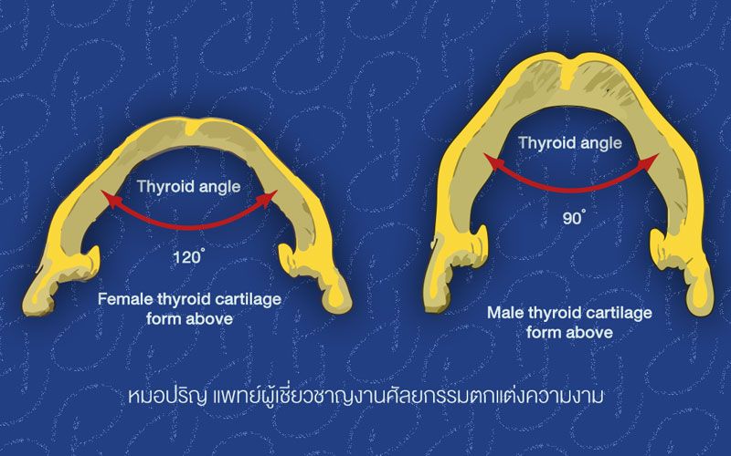 อันตราย? แพทย์แนะทำความเข้าใจเกี่ยวกับการผ่าตัด ‘ลูกกระเดือก’