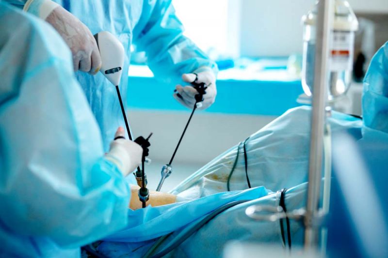 ‘ผ่าตัดผ่านกล้อง’ ทางเลือกการรักษาผู้ป่วยมะเร็งลำไส้ใหญ่