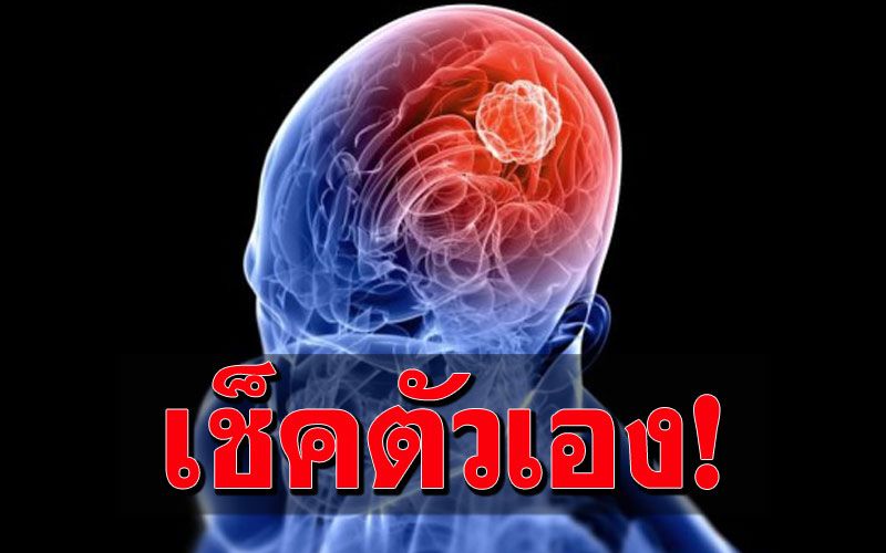 กรมการแพทย์เตือนโรคร้าย 'เนื้องอกในสมอง'พบได้ในทุกเพศทุกวัย
