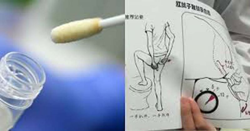 Health News : แหย่ทวารหนักหาเชื้อโควิด-19