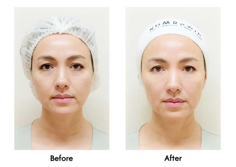 เชื่อหมอ! รอยหมองคล้ำรอบดวงตา  เริ่มมาเยือนตั้งแต่วัย 20 ต้นๆ