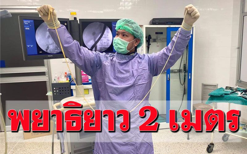 หมอผ่าตัดนิ่วต้องตกตะลึง! เจอพยาธิตัวตืด ออกจากปากผู้ป่วย2เมตร!!