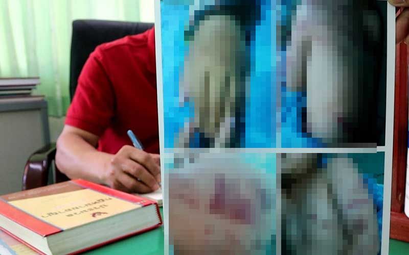 แฉกันยับ! พ่อแท้ๆแจ้งเอาผิดพ่อเลี้ยงทุบลูกน่วมทั้งตัว ฝั่งแม่เด็กซัดกลับอีกมุม