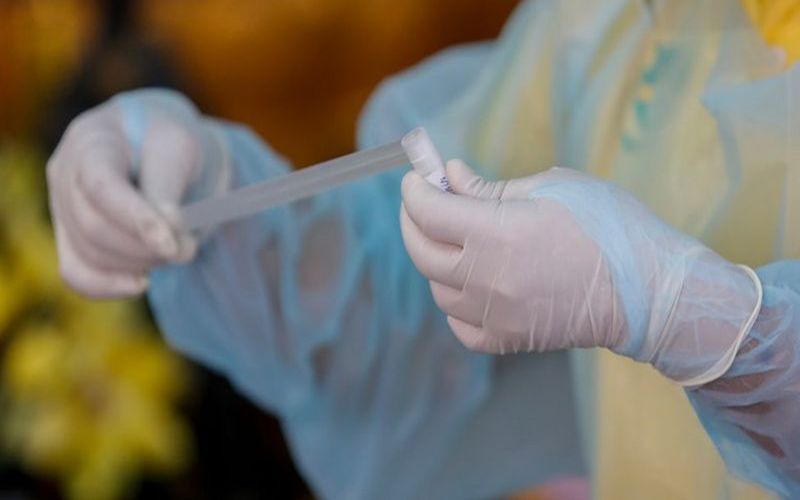 การตรวจหาเชื้อโควิดทางทวารหนัก : อาทร จันทวิมล