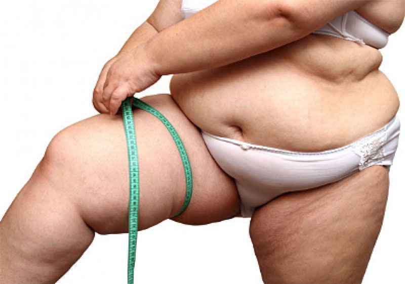 สกู๊ปพิเศษ : ‘อ้วน’ประตูสู่สารพัดโรค หลากปัจจัยเสี่ยงต้องป้องกัน