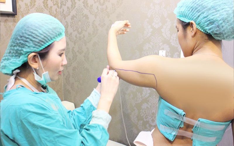 คุณหมอแนะก่อนดูดไขมันต้องเช็คให้ชัวร์ ความปลอดภัยต้องมาก่อน