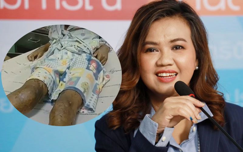 'ครูกัลยา'ห่วงนักเรียนถูกราดซีม่า เตรียมส่งทีมลงพื้นที่เยี่ยมเด็ก