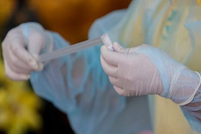 เซฟเก็บไว้เลย! ทำอย่างไร? เมื่อทราบผลตรวจติดเชื้อโควิด-19