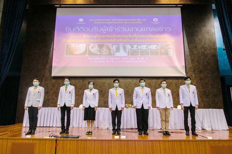 รพ.จุฬาฯรักษาผู้ป่วยโรคผิวหนังแข็งที่มีปอดเป็นพังผืด  ด้วยการปลูกถ่ายสเต็มเซลล์สำเร็จเป็นครั้งแรกในไทย