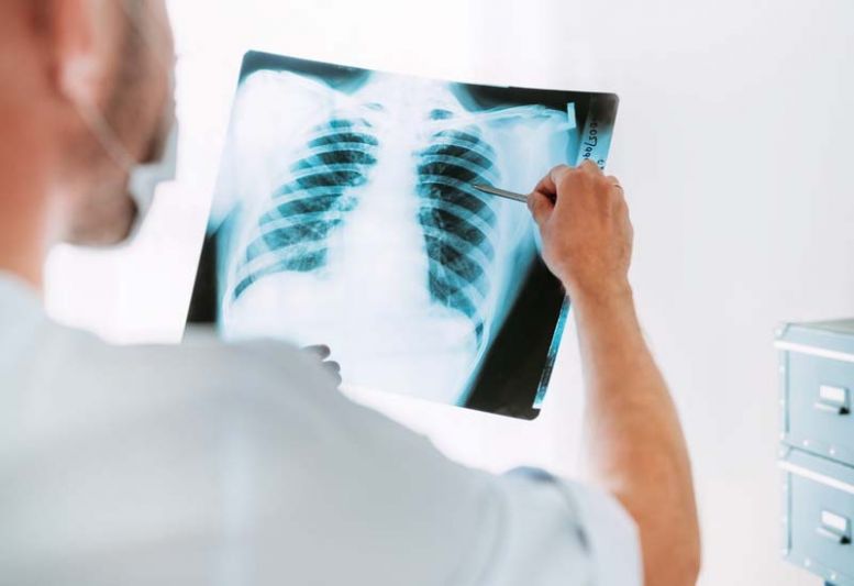 รู้ทันโรคช่วยลดความเสี่ยงมะเร็งปอด