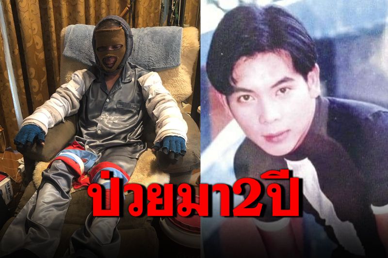 'ผี ไฮแจ็ค'เล่าอาการป่วยมา 2 ปี เผยภาพล่าสุดใส่เสื้อผ้าคลุมมิดชิด