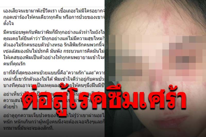 เปิดโพสต์สุดช้ำแฟนสาว'ทอยทอย' โดนทำร้ายจนกลายเป็นโรคซึมเศร้า