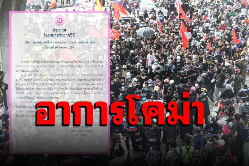 รพ.ราชวิถี เผยวัยรุ่นชายถูกยิงจากเหตุชุมนุม พบกระสุนค้างที่ก้านสมอง1นัด อาการโคม่า