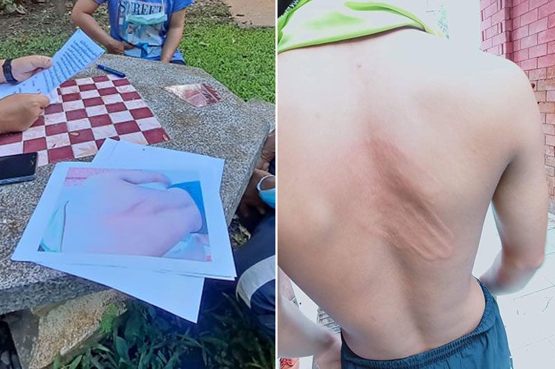 ตีอย่างแรง! เด็กนักเรียนถูกครูทำร้าย โดนตบกลางหลังขึ้นรอยปื้นแดง