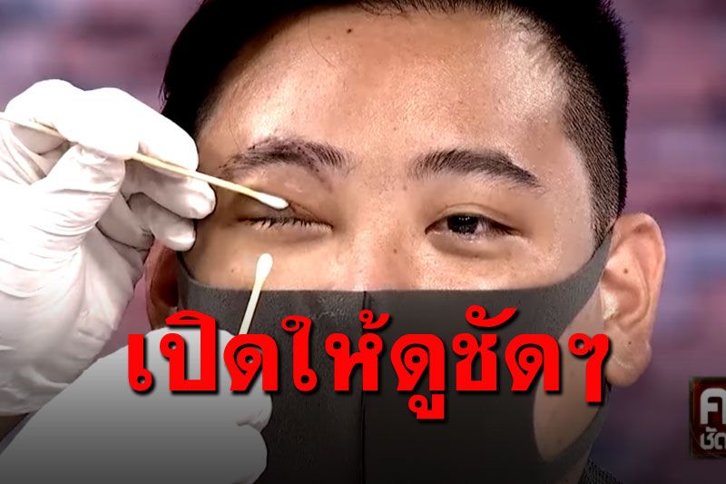 'ไฮโซลูกนัท'เปิดให้ดูกลางรายการ ตาบอดจริงหรือไม่!? (คลิป)