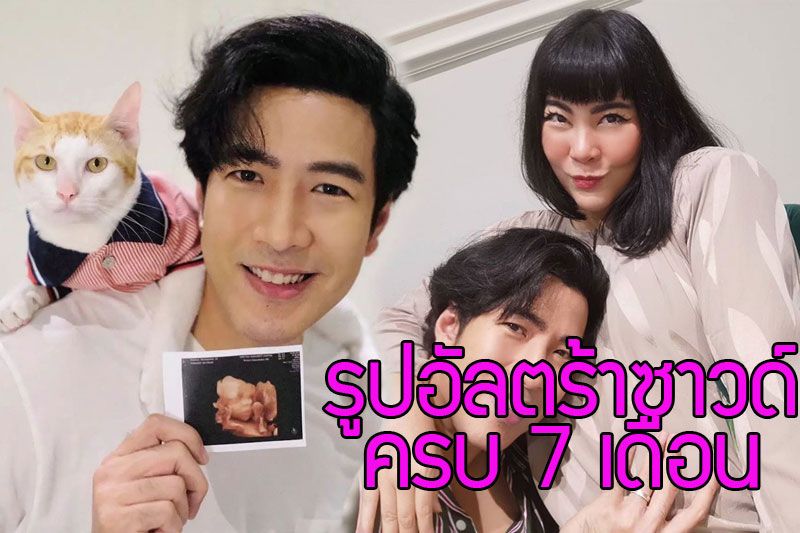 มาแล้วรูปแรกของลูกสาวพ่อ'โย่ง อาร์มแชร์'กับรูปอัลตร้าซาวด์ครบ7เดือน