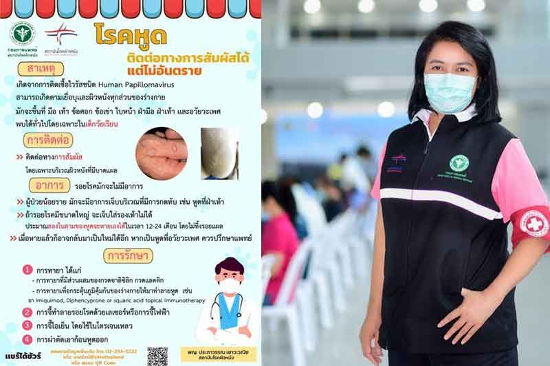 แพทย์ผิวหนังเผยโรคหูดติดต่อทางการสัมผัสได้แต่ไม่อันตราย