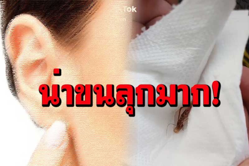 ขนลุกซู่! สาวปวดหูกลางดึก ผงะ'แมลงสาบ'มุดรูหูวางไข่ เคราะห์ดีหมอคีบออกได้