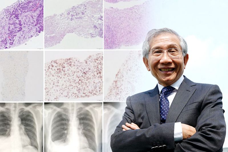 การรักษามะเร็งเต้านมด้วยภูมิบำบัดครั้งแรกของโลก  ความหวังครั้งยิ่งใหญ่ของผู้ป่วย