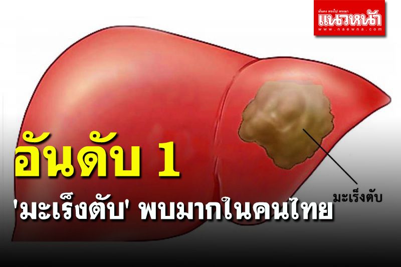 แพทย์เผย 'มะเร็งตับ' พบมากเป็นอันดับ 1 ของคนไทย