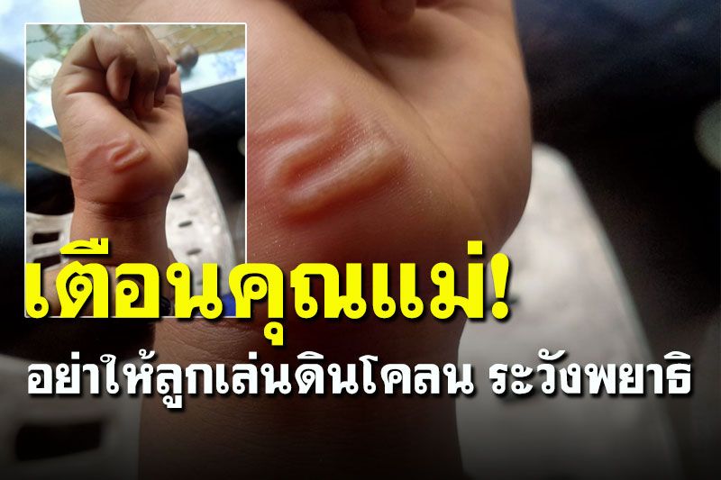 โถ่ลูก... สงสารมาก! สาวโพสต์เตือนคุณแม่อย่าให้ลูกเล่นดินโคลน