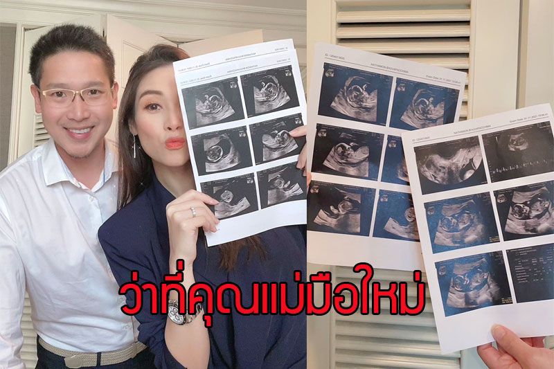 'ปอ ณฐมน' ว่าที่คุณแม่มือใหม่ ประกาศท้องแล้วจ้า !