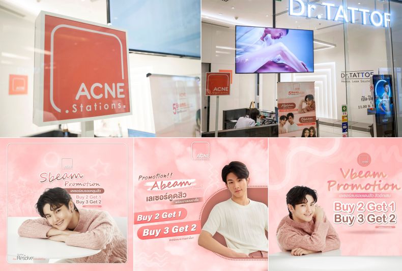 Acne Stationsสเตชั่นรักษาสิวด้วยเลเซอร์
