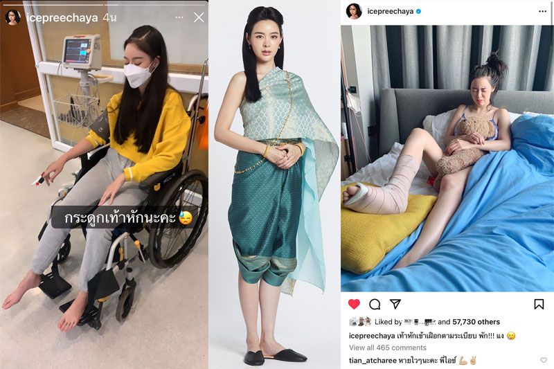 หามด่วน 'ไอซ์-ปรีชญา'เข้าโรงพยาบาลกลางดึก เกิดอุบัติเหตุ กระดูกข้อเท้าหัก!!