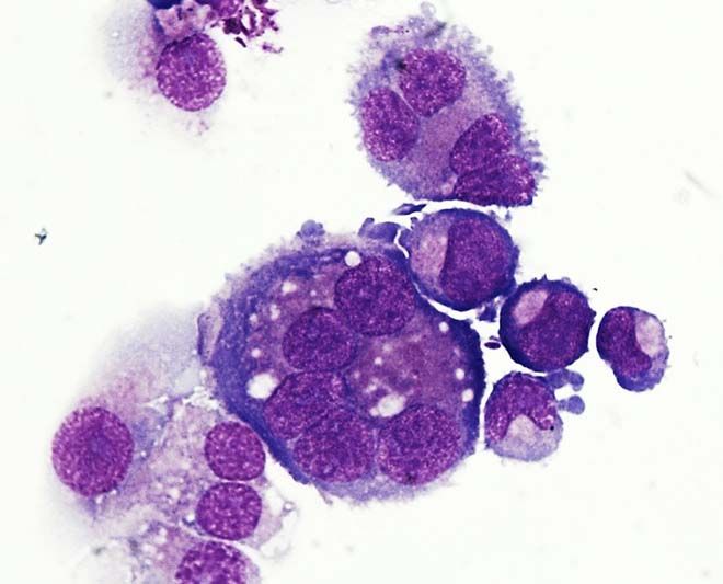 นักวิจัย‘มหิดล’พบวิธีกระตุ้นสร้างเกล็ดเลือด ลดวิกฤตขาดแคลนผู้บริจาค