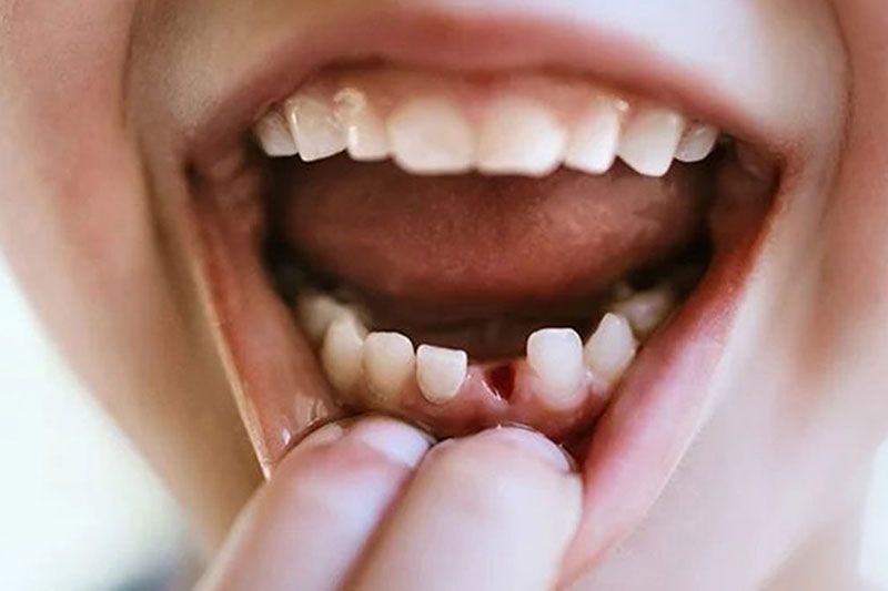 'กรมการแพทย์'ชี้ยาสีฟันไม่ช่วยให้ฟันแท้ขึ้นใหม่ หมั่นดูแลช่องปาก-ฟันตนเองดีที่สุด