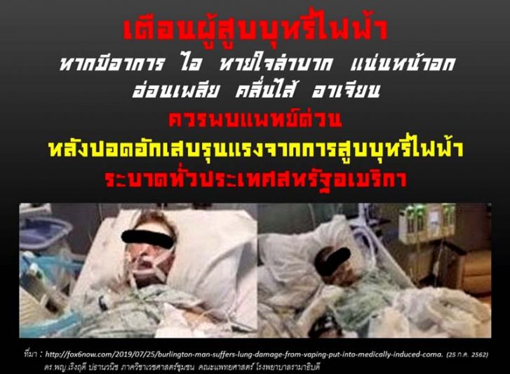 แพทย์ย้ำ‘บุหรี่ไฟฟ้า’ของอันตราย  ค้านปลดล็อก-จี้เร่งปราบปรามจริงจัง