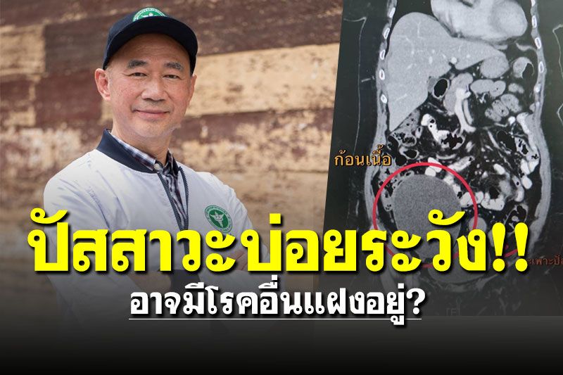 แพทย์เตือน! ปัสสาวะบ่อยอย่าคิดว่าเป็นแค่เบาหวาน อาจมีโรคอื่นแฝงอยู่?