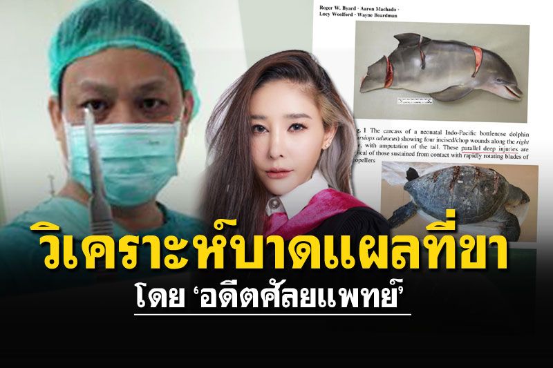 'อดีตศัลยแพทย์'เผยผลวิเคราะห์บาดแผล ขาของ'แตงโม'