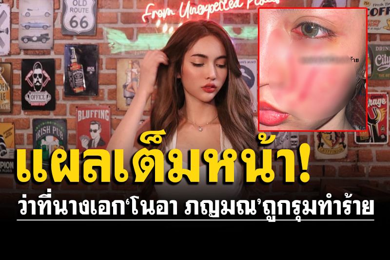 ว่าที่นางเอก'โนอา ภญมณ'หน้าพัง อ้างถูกคู่อริเก่ารุมทำร้าย กระชากเสื้อจนโป๊ เสียรายได้หลักล้าน