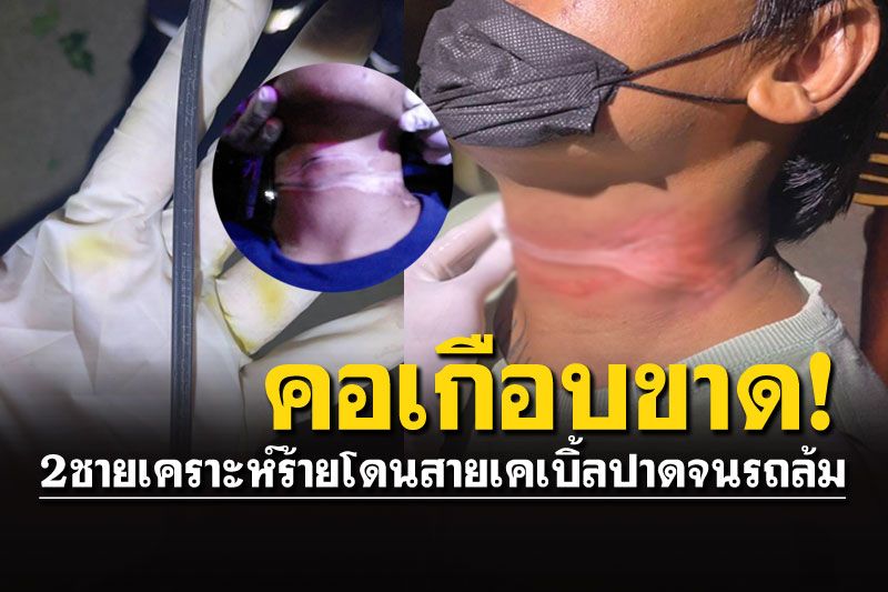 เสียวสยอง! 2หนุ่มขับมอไซค์มาดีๆ เจอสายเคเบิ้ลปาดคอหวิดขาด