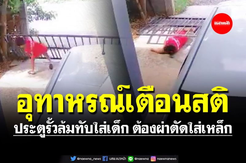 อุทาหรณ์เตือนสติสอนใจ! ประตูรั้วล้มทับใส่เด็ก ต้องผ่าตัดใส่เหล็ก-ทำกายภาพ1ปี