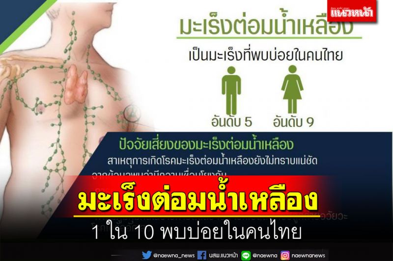 ‘มะเร็งต่อมน้ำเหลือง’ 1 ใน 10 พบบ่อยในคนไทย แนะ‘คลำ’พบโต รีบพบแพทย์