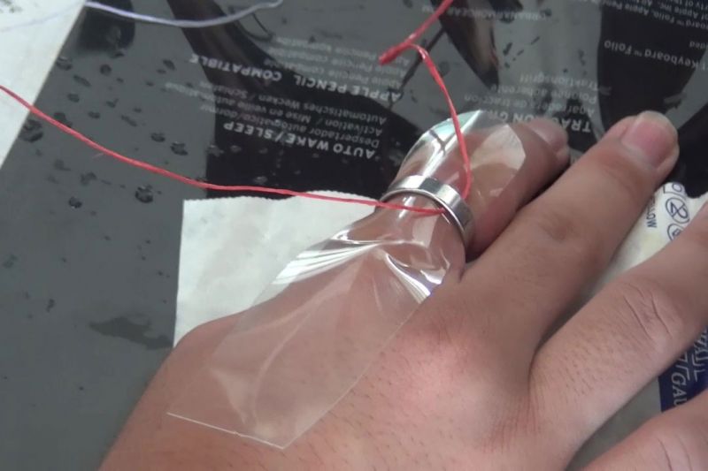กู้ภัยอุดรช่วยหนุ่มน้อยวัย 14 ปี ตัดแหวนติดนิ้วออกได้หวุดหวิด