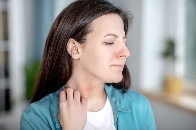 โรคลมพิษเรื้อรัง อย่ามองข้ามจนลุกลามรุนแรง