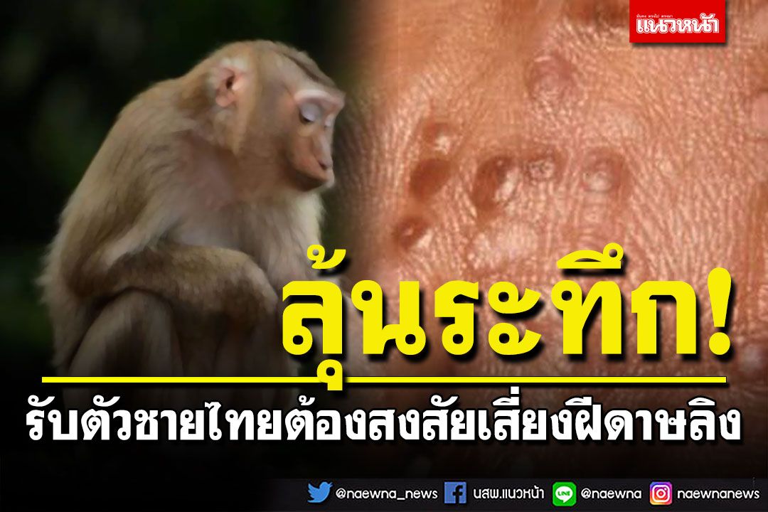 ภูเก็ตระทึก! รับตัวชายไทยต้องสงสัย เสี่ยง'ฝีดาษลิง' ส่งตัวรักษาด่วน