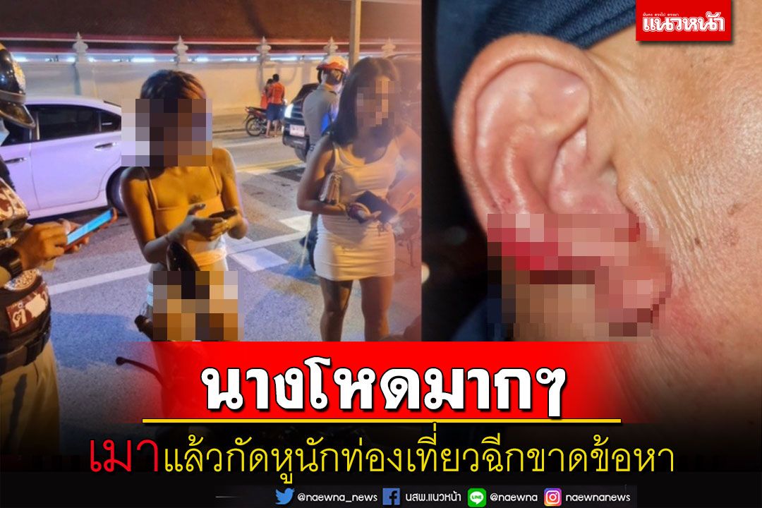 ตร.พัทยาดำเนินคดีสาวเมากัดหูนักท่องเที่ยวฉีกขาดข้อหา 'ประพฤติตนวุ่นวาย'