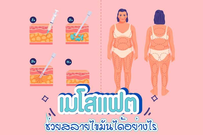 ฉีดแฟตสลายไขมันจุดไหนได้บ้าง มีข้อจำกัดเรื่องอะไรบ้าง?