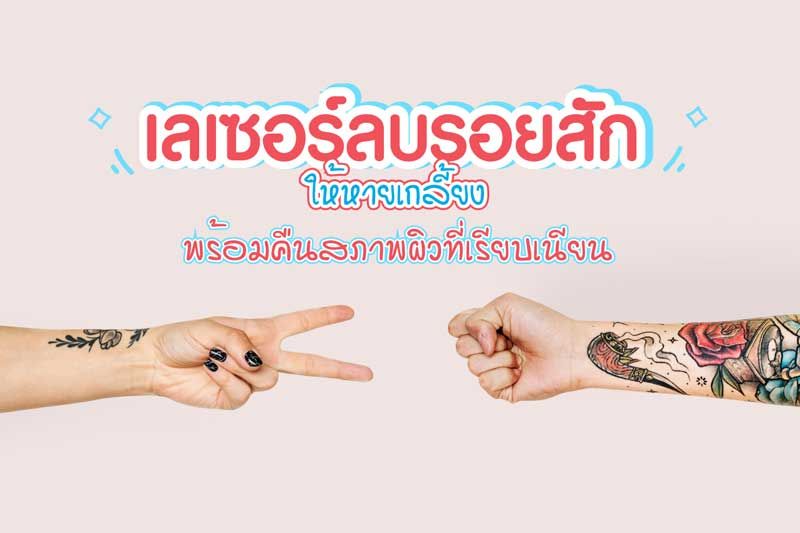 How To ลบรอยสักด้วยเลเซอร์ มีหลักการทำงานอย่างไร ทำไมถึงไม่เป็นแผลเป็น