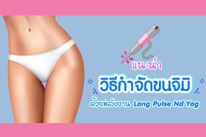 เลเซอร์กำจัดขนน้องสาวด้วยพลังงาน Long Pulse Nd Yag เพื่อไม่ให้ผิวน้องสาวบอบช้ำ